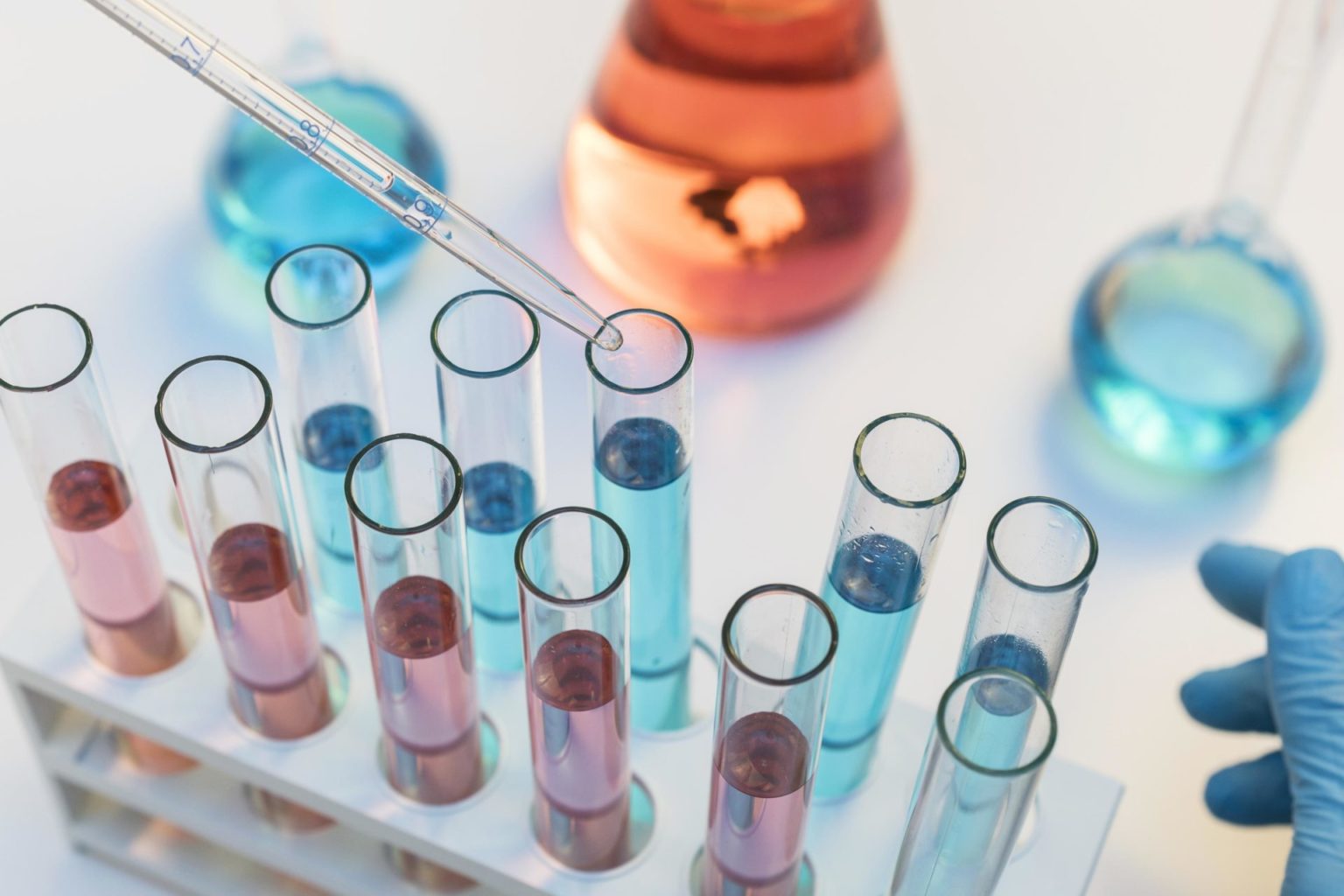 Lab Supply Management Laboratory Supply Inventory Management